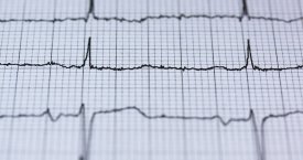 Specialistai ragina pasitikrinti: širdies ligos kamuoja ir trisdešimtmečius