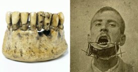 Senovės odontologijos stebuklai (foto)