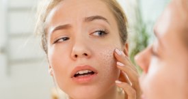 Dermatologė įspėja: sausas oras patalpose – sparčiai pradėjusios senti odos priežastis