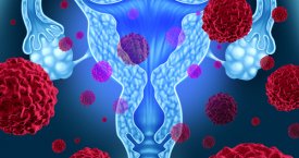 Gydytoja ginekologė: kodėl svarbu reguliariai tirtis dėl gimdos kaklelio vėžio?