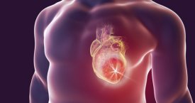 Gydytojų perspėjimas sergantiems širdies ligomis: nenustokite tai daryti – pasekmės gali būti skaudžios
