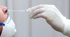 Lietuvoje registruota 105 nauji koronaviruso atvejai