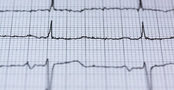 Specialistai ragina pasitikrinti: širdies ligos kamuoja ir trisdešimtmečius