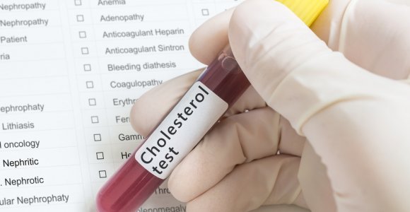 Cholesterolio „baubas“: ar reikia bijoti?