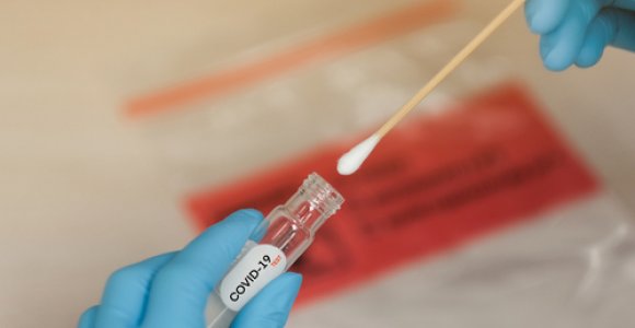 Per vakar Lietuvoje patvirtinti 9 nauji užsikrėtimo koronavirusu atvejai