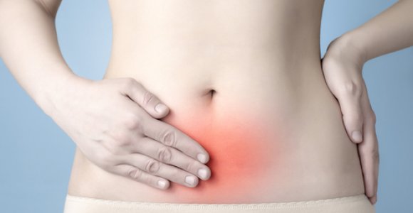 Endometriozė – mitais apipinta liga