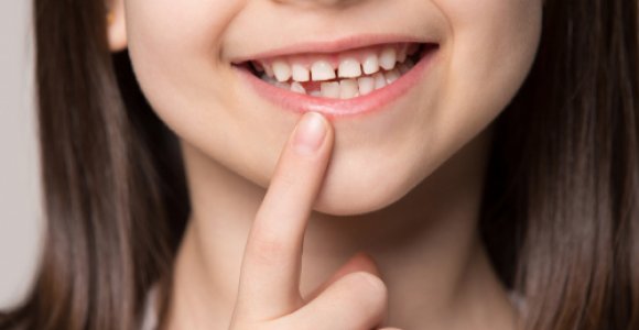 „Sveikata.lt“ laidoje: kaip reikėtų prižiūrėti vaikų dantis?