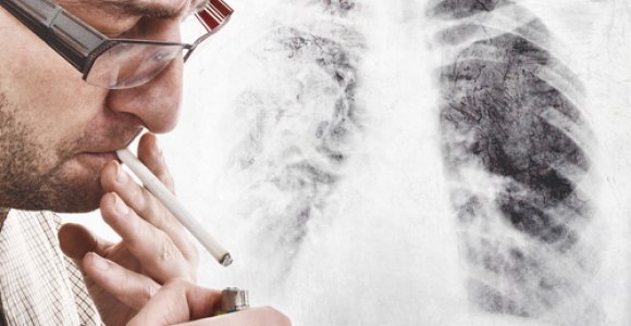Klastingasis plaučių vėžys: pastebėkite jį laiku